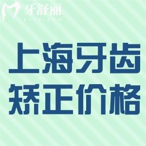 全新上海牙齒矯正價(jià)格表:全年齡金屬矯正6000+隱形矯正20000+更劃算