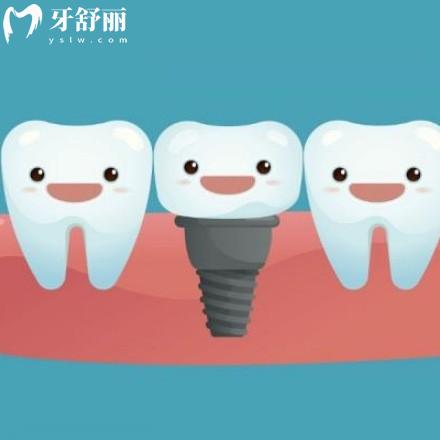 2024新版株洲口腔醫(yī)院種植牙價(jià)格表全,get種植牙比較好的牙科醫(yī)院多少錢一顆