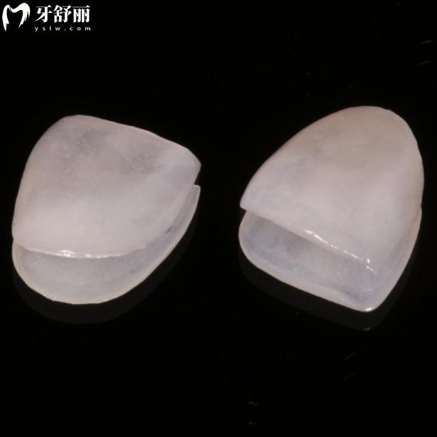 義獲嘉藍瓷貼面