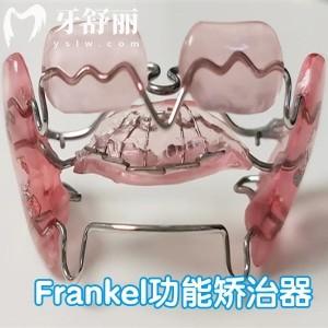 Frankel功能矯治器