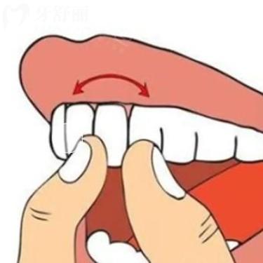 牙齒用手晃有點(diǎn)松動(dòng)正常嗎？會(huì)自己長(zhǎng)好嗎？