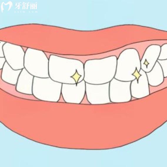 30歲做了滿口烤瓷牙能用一輩子嗎？老了還能用嗎？