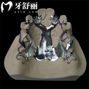 維他靈支架和純鈦支架哪個(gè)好?