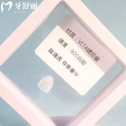 ??VITA琥珀瓷貼面