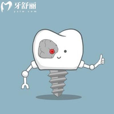 承德種植牙多少錢一顆2025價格表:單顆/半口/全口收費2580-30000元起