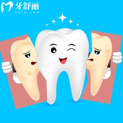 牙齒美白的方法哪種有效？是不是智商稅？
