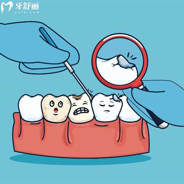 齲壞后補了牙的牙齒還會爛到牙髓么?