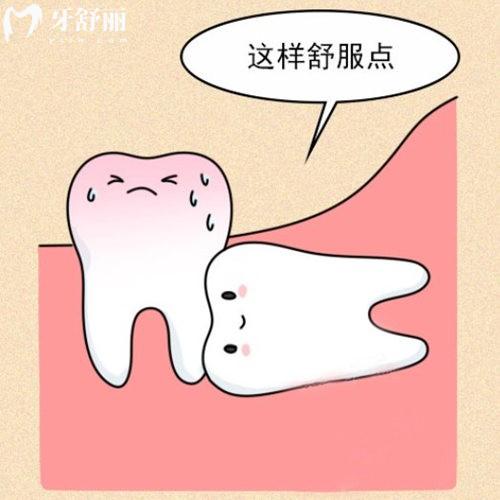 簡單智齒和復雜智齒如何判斷?
