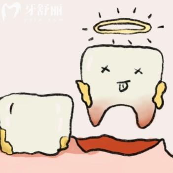 先洗牙還是先拔牙補(bǔ)牙？
