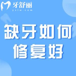 缺牙時(shí)種牙齒好還是鑲牙齒好?