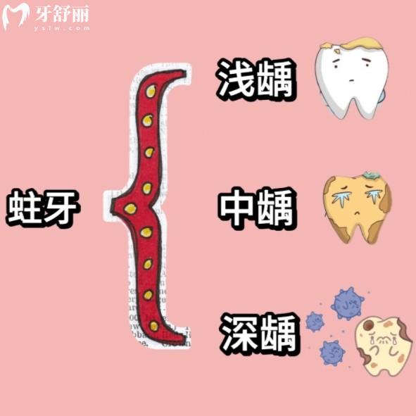 蛀牙不疼也要補是過度醫(yī)療嗎？