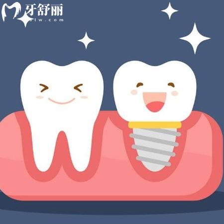 西寧市種牙價格表新版2025:參考中諾2680+諾貝爾2800+非凡1880+