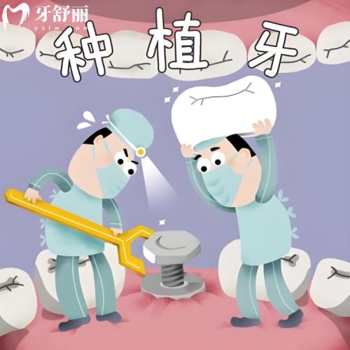 2025青島可恩口腔醫(yī)院種植牙價目表公布單顆多顆半口全口種植牙價格一覽表