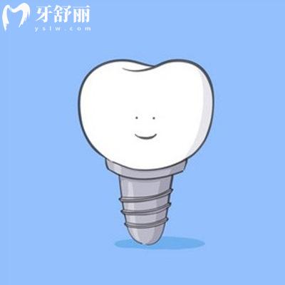 德國ABT種植體壽命多少年?揭秘ABT種植體優(yōu)缺點(diǎn)及收費(fèi)價(jià)格