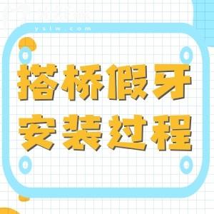 搭橋假牙安裝過程圖片分享:性價(jià)比高的假牙修復(fù)方式來詳細(xì)了解