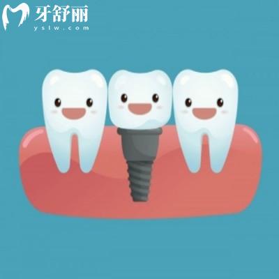2025鄭州地區(qū)口腔醫(yī)院價格表出爐:種牙/矯正/補牙費用全公開